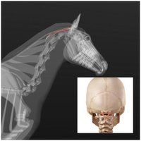 THE RECTUS CAPITIS POSTERIOR MINOR